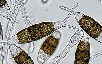 Growth of Pestalotiopsis fungus on different media